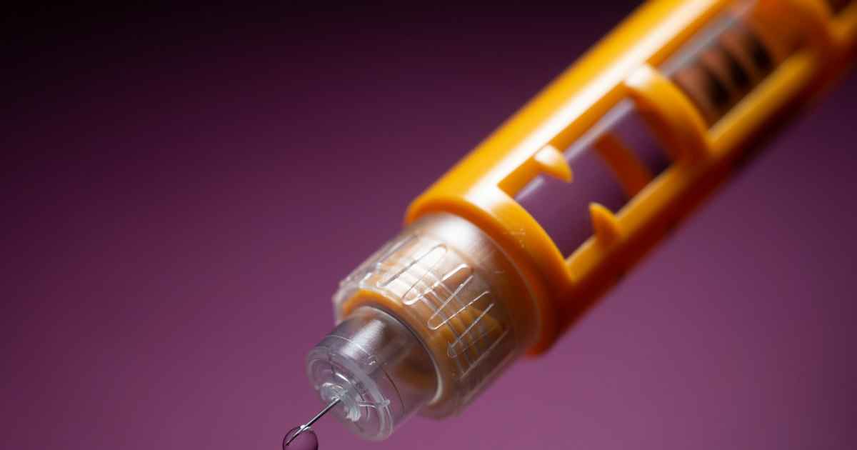 Trenbolone Hexahydrobenzylcarbonate and the Skin: Acne and Oiliness